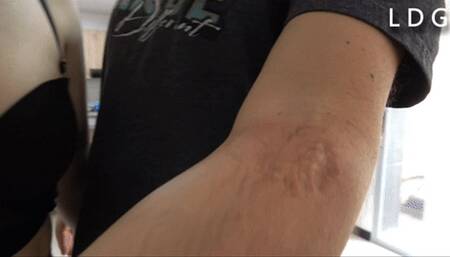 Alison Biting Walking And Leaving Big Marks