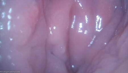 bladder exam turns me on (720 mp4)