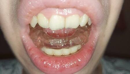 I play with the bite