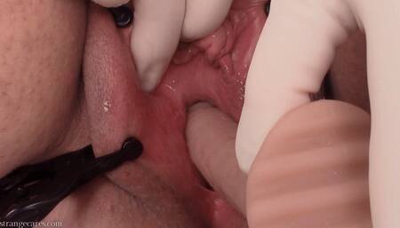 urethra dildo and latex surgical gloves (1080 wmv)