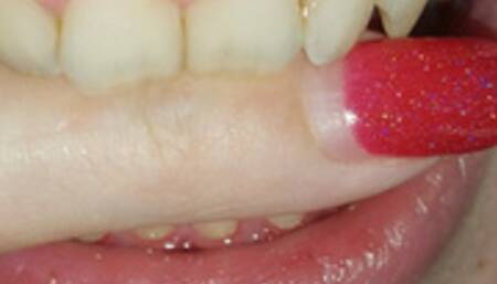 I bite my finger ---