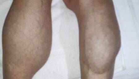 Iron Ivy, the white sheets, calves, blue veins