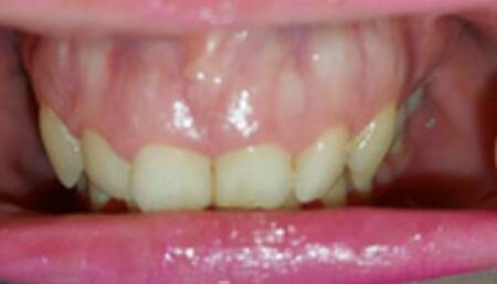 beautiful teeth tour