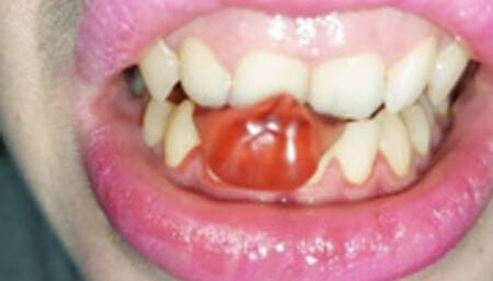 I destroy and eat gummy bears with my teeth --