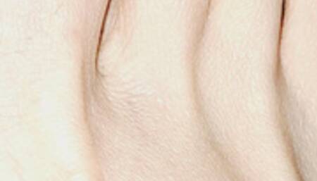 Peeling A HUGE Toe Skin Flake