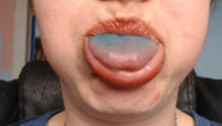 Blue tongue blowing raspberries