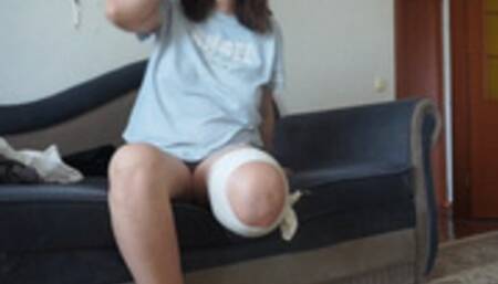 Amputee leg dressing on Date