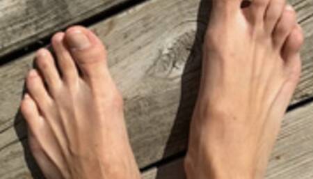 Long, BONY, pretty feet with black BRUISED toe nail