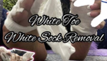 White Toe White Sock Removal