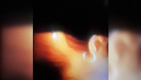 Suck ut out luck ituo