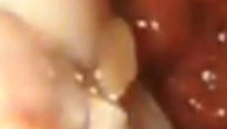 Whole chicken digestion endoscopy 1080HD