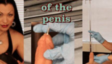 Proliferation of the Penis