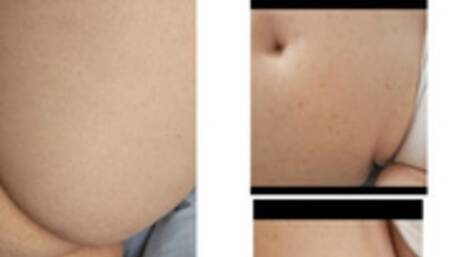 New Belly Noises Plus SNEEZING AND FARTING