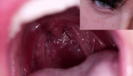 VORE Ignore (Mobile)