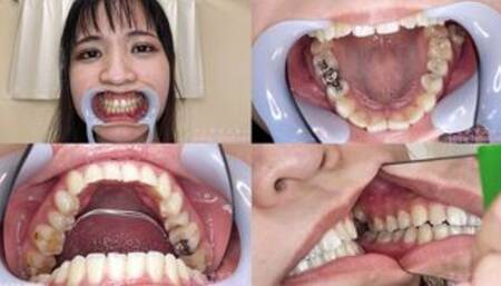 Rin - Watching Inside mouth of Japanese cute girl bite-239-1 - wmv 1080p