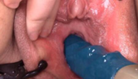 stronic in my peehole for the first time