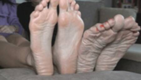 wrinkled skin feet