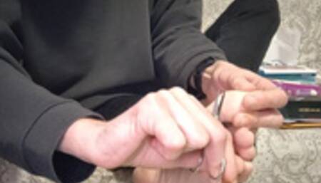 I eat the aliens that have infected my feet