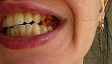 chew gummy bears order