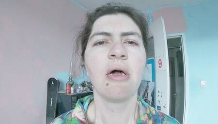 Little sausage hiccup