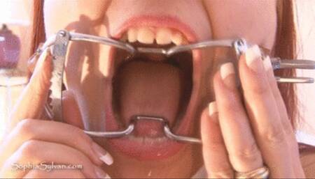 Look Deep into My Mouth- Dental Gag Closeups 720p wmv