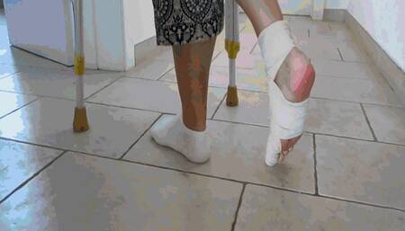 Severe pain in the toe AVI(1920*1080)HD
