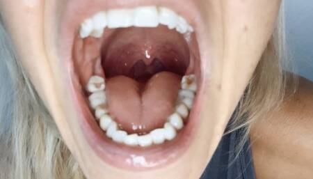 You or your brother?