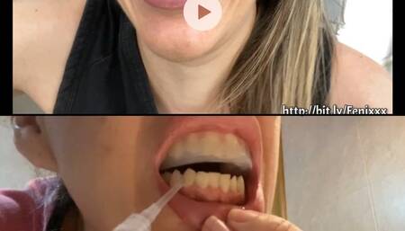 BURCHING WITH A DIRTY MOUTH AND Teeth Whitening