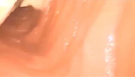 Very problematic medical vore anal exploration 1080HD