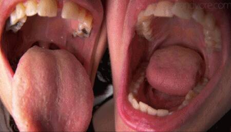 Your Two Aunties Want To Gobble You All Up For Breakfast (POV Vore)