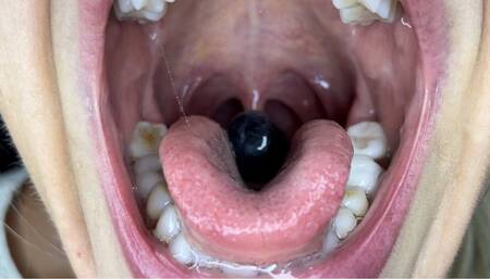 Human for dinner after fruit