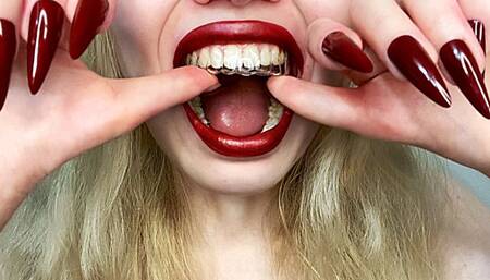 Orthodontic Cap and Spitting