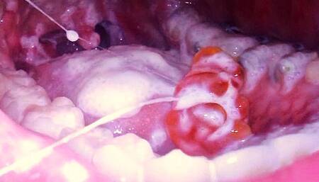 Tiny Spy in My Food - CUSTOM