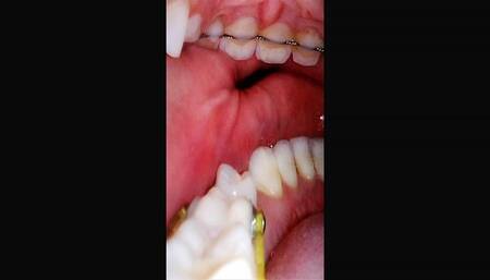 Inside My Mouth Reverse