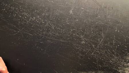 Nose Blowing with yellow mucus!