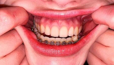 Teeth Examination 1080p