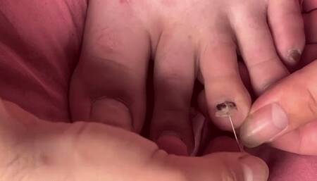 poking a fake fingernail with pins