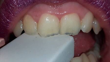 I destroy an eraser with my teeth