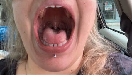 Post Dentist Mouth Tour with Novocaine 1080p mp4