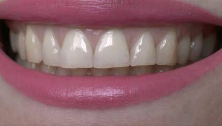 You excite me so much when you show off your perfect and razor sharp teeth MP4 FULL HD 1080p