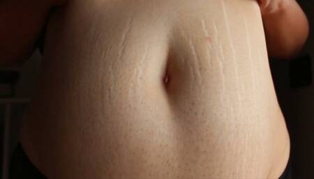 Belly Stretch Marks [MOV]