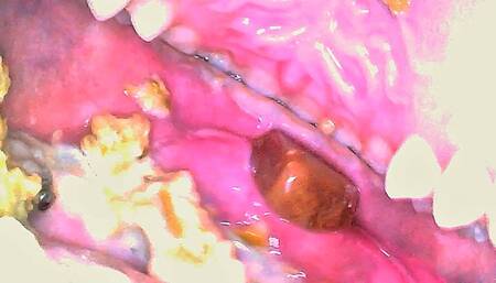 Ugly Chewing - CUSTOM