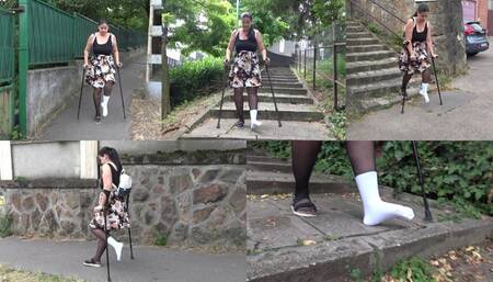 About My Bunion Part2