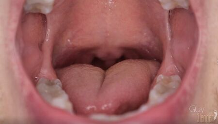 Close Up Mouth Teeth Tongue Uvula Spit