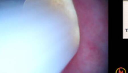 Trussardi Lights 100s inside