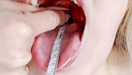 Mouth Measuring CUSTOM