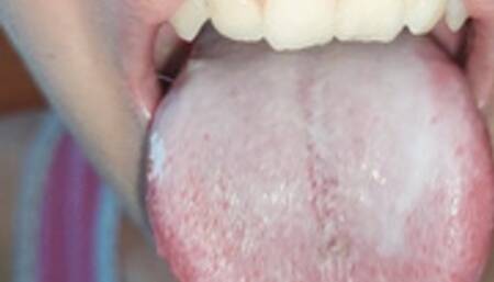 admire my white tongue very close to the camera