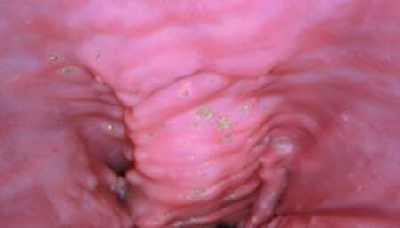 Pulsing Gspot 6 Orgasms