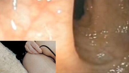 Medical fetish anal exploration