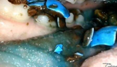 Reverse chewing inside my mouth